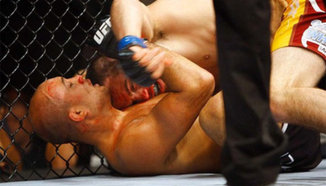 Jon Fitch не е убеден, че заслужава мач за титлата