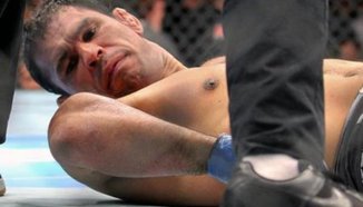 Anotnio "Minotauro" Nogueira оперира счупената си ръка