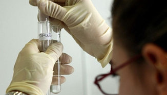 Изготвят списък на спортисти за допинг контрол