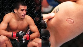 Игор Северино наказан за девет месеца заради ухапване на опонент в UFC